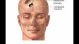 1.Magdy Said,clinical anatomy,fractures of the skull