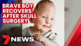 Sydney boy undergoes life-saving surgery, re-shaping skull bones | 7NEWS